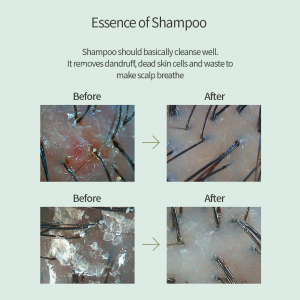 Fore.D Shampoo (500g) Fore.D Shampoo Before After