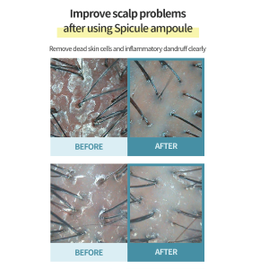 Spicule Complex (70ml) Spicule Complex before after