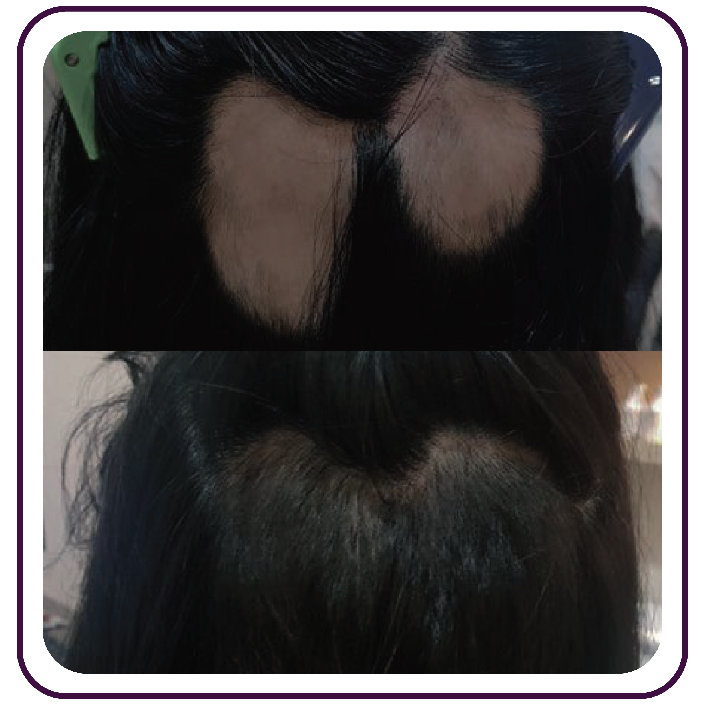 Home Dr.Scalpt_B&A-03-min